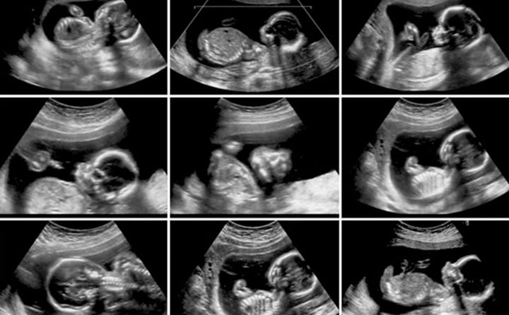 Sixteenth-week-of-pregnancy-8