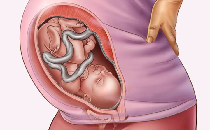 Thirty-second-week-of-pregnancy-5