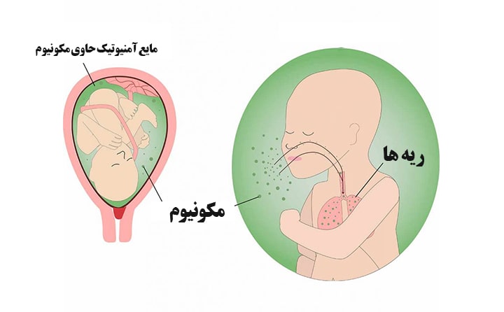 Thirty-sixth-week-of-pregnancy-6