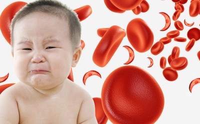 کم خونی در کودکان: علائم مهم و راه‌های اصولی درمان آن